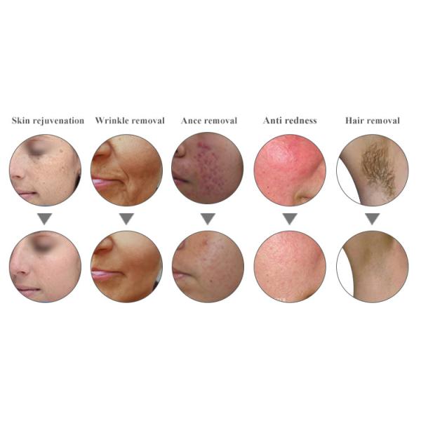 Skin Tightening Optical Ipl Hair Removal Machine 610nm Multi Pulse