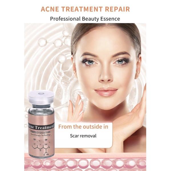 Stalidearm Acne Treatment Face Meso Serum Anti Acne Pimple Scar Remover Moisturizing Whitening Skin Care Facial Essence