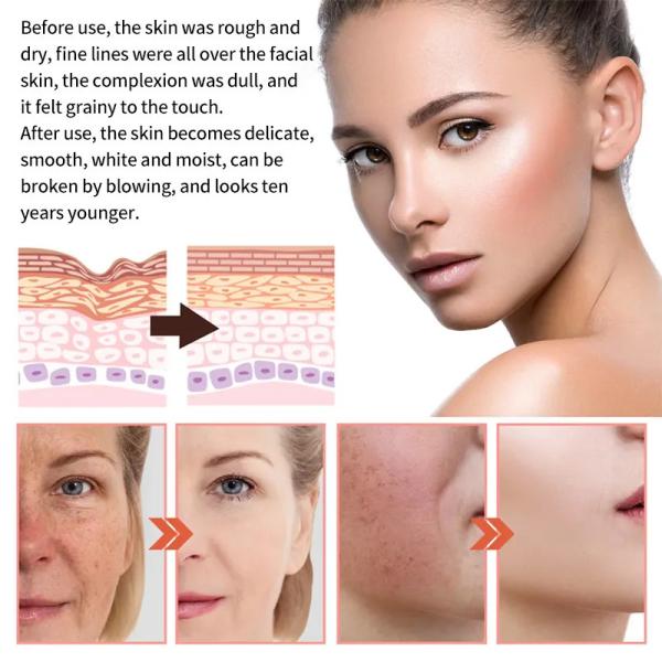 5 In 1 Skin Care Serum Dark Spot Whitening Serum Vitamin C Facial Serum