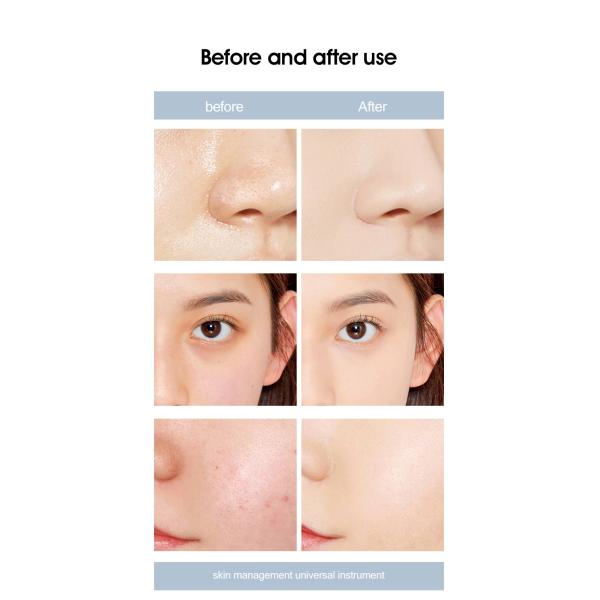 9-в-1 бриллиантовый пилинг-машина с кислородным струем воды для аква дермабразии глубокое очищение Кожа затягивание и лингирование