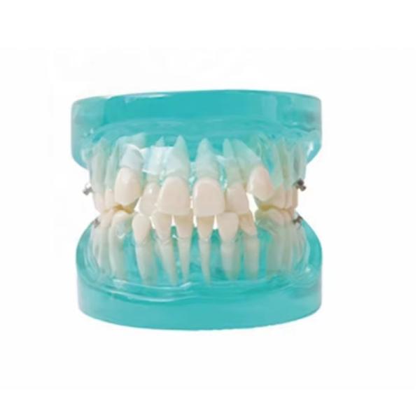Multi Color Human Teeth Model For Study Dental Orthodontic Teeth Model With Bracket