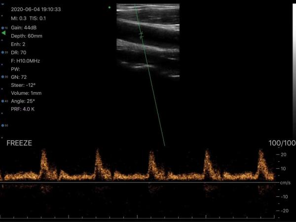 Linear/Convex/Phased Array 3 in 1 Handheld USB Ultrasound Double Probes Wireless Color Doppler Scanner
