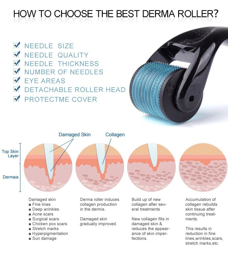 Beauty Microneedle Instrument 540 Needle Microneedle Facial Skin Roller for Nose