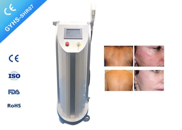 Vascular Therapy IPL SHR Hair Removal Machine,  Acne Spots SHR  IPL Lazer
