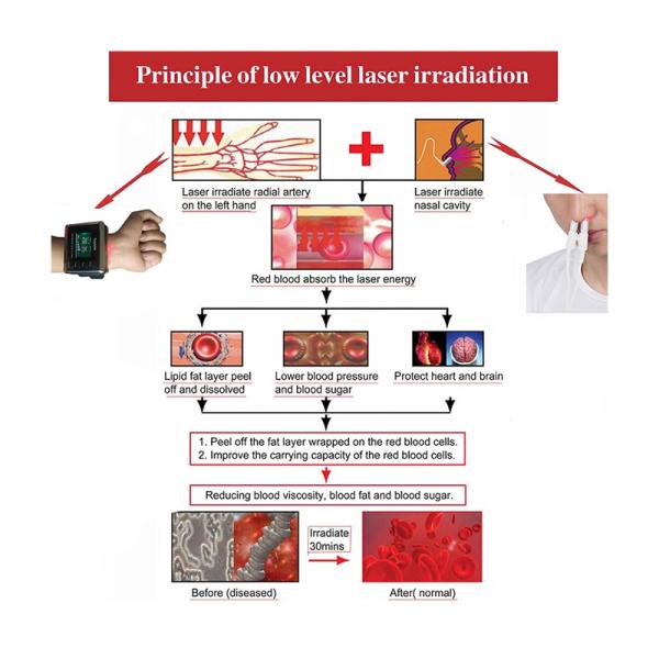 FDA Portable Laser Watch For High Blood Pressure ，Medical Physical Therapy Equipment