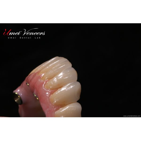 Biocompatible zirconia bridges