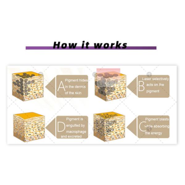 1064nm 532nm 755 Yag Picosecond Laser Tattoo Removal Machine