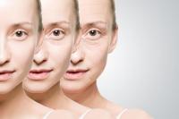 Ácido hialurónico Gel labial Injecções Rugas oculares Filler cutâneo sintético de ácido hialurónico