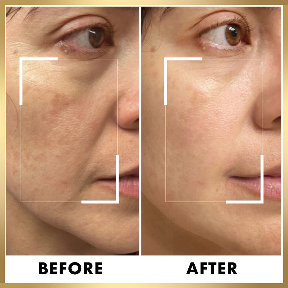 OEM ODM 24k Gold Skin Care Set face cream Facial Cleanser Organic Acne essence Wholesale Purifying Pore Breaking Melanin face cream Deep Cleaning Facial Moisturizing facial mask