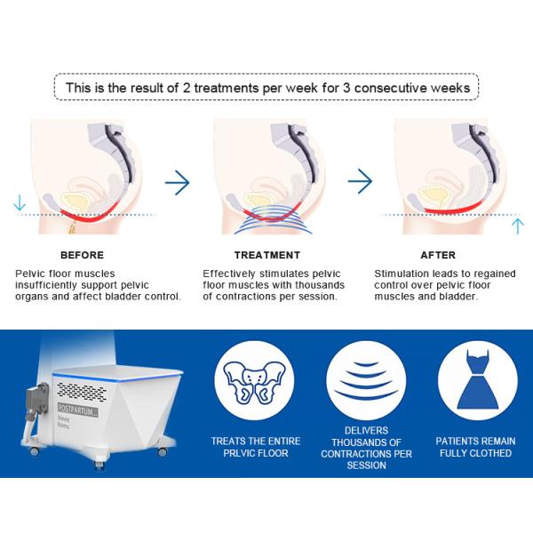 OEM 7 Tesla Pelvic Floor Muscle Strengthening Machine 2 Working Handles