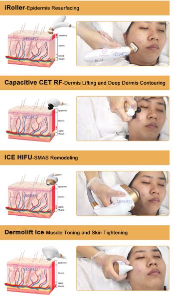 7D 12D 14D ICE HIFU Face Lifting Wrinkle Removal HIFU Machine