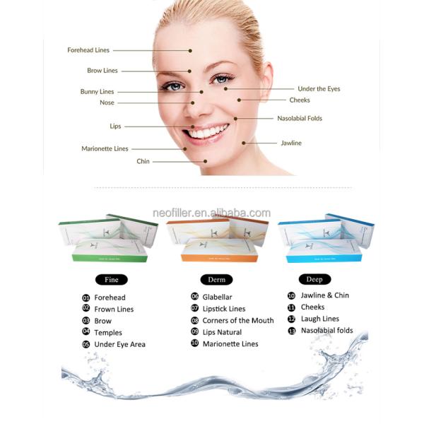 Крест Derm заполнителя Neofiller Hyaluronic кисловочный дермальный соединенный для губ вводимых