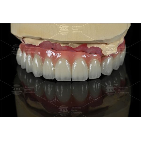 Hypoallergenic PFZ dental solutions tailored to meet diverse clinical and dental lab needs services ensuring precision
