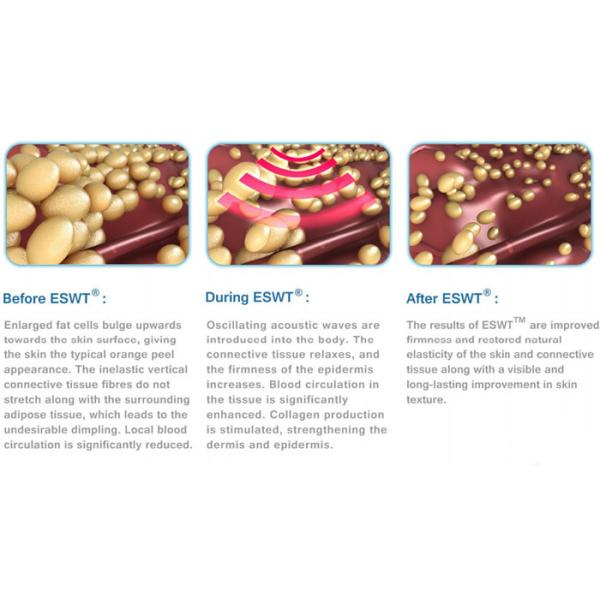 Применять обложку к затягивать машину 10 обработки целлюлита к непрерывно энергии 190мдж