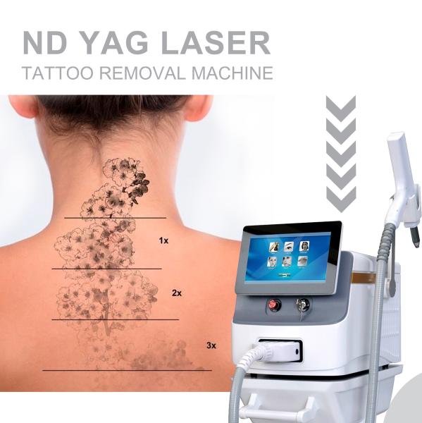 Q Switch Nd YAG Laser Tattoo Removal Machine 1064nm 532nm 1320nm 2 Years Warranty