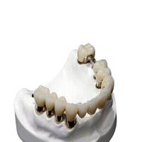 Resistência de corrosão da dentadura do acessório da precisão do CR MK1 do CO