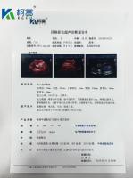 Película seca médica transparente de inyección de tinta Película de rayos X blanca para el dispositivo radiológico CT DR MRI