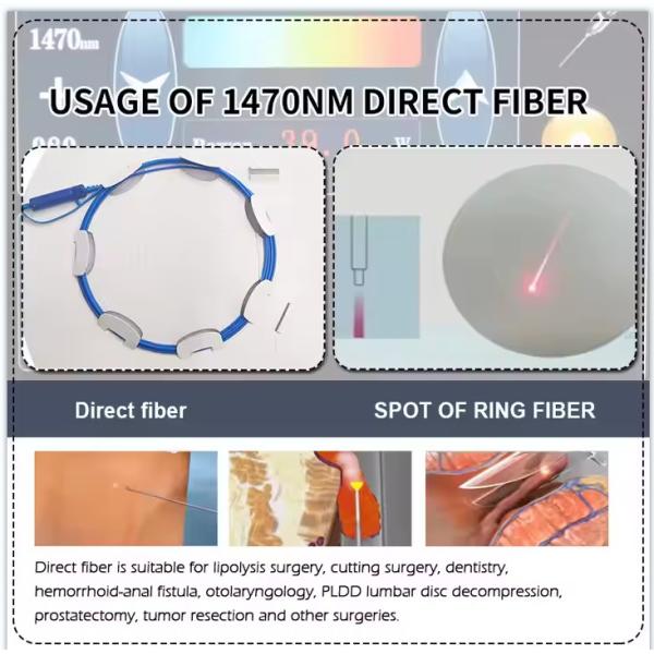 Skin Rejuvenation Body Sculpture 1470nm Endolift Fiber Coupled Laser Diode Machine