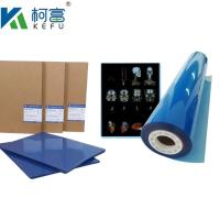 Customized Size 35x43 Inkjet Blue Medical X Ray Film For Epson A4  PET Dry Blue Medical Laser Xray