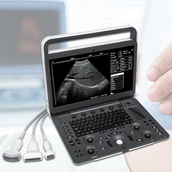 High Quality Ultrasonic SonoScape E2 with Ultrasonic Sensors