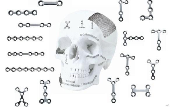 Metallic Maxillofacial Implants Double Y Sharped Mini Plate OEM Available