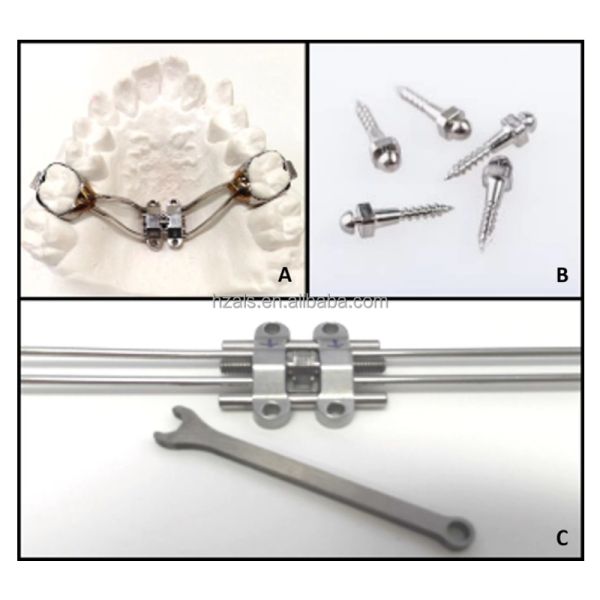 Maxillary Skeletal Expander MSE Palatal Expander Device For Orthodontic Clinic Use 1 pc/pk MSE Size 8 10 12 Available