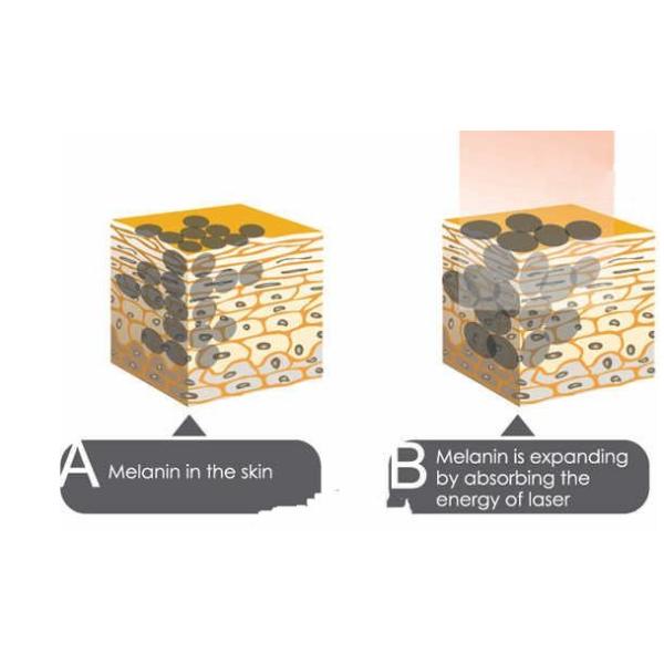 Y11 1064nm / 532nm Tattoo Removal machine For Eyebrow / Embroider Lip