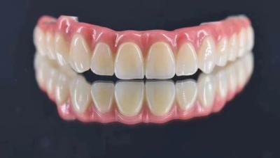 Dental Lab Customized Implant Supported Metal Crown Natural Looking For Long Term Stability