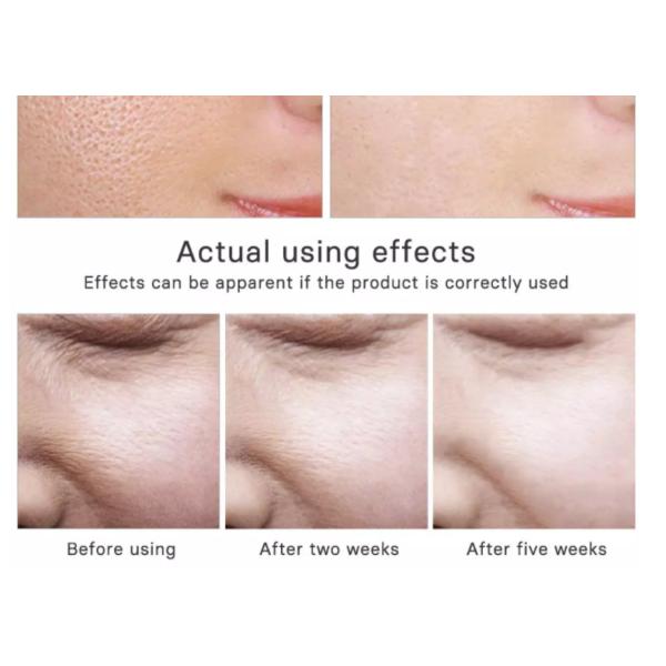 сыворотки стороны сусального золота 24k вызревание органической анти- для кожи комбинации