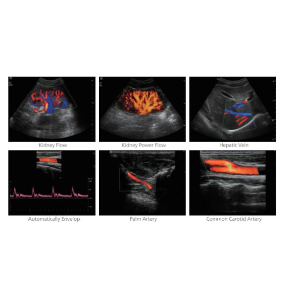 S20 Sonoscape Ultrasound Sonoscape Ultrasound s2 Ultrasound Scanner Sonoscape