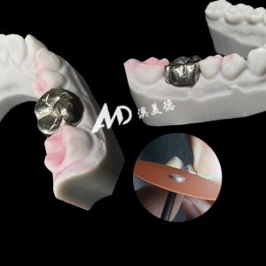 Metal Titanium Crown Precision Strength and Biocompatibility for Lasting Restorations