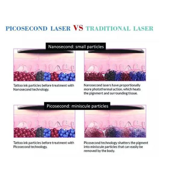 Picosure / Nd Yag Laser Tattoo Removal Machine Portable  Type With Touch Screen