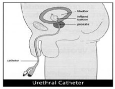 Емкость пути 8-24Fr 5-30cc катетера 2 Foley силикона больницы