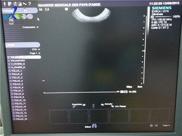 Зонд Endocavitary датчика ультразвука Сименс EV-8C4