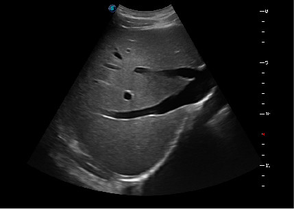 4D Trolley Color Doppler SonoScape Ultrasound Machine S22