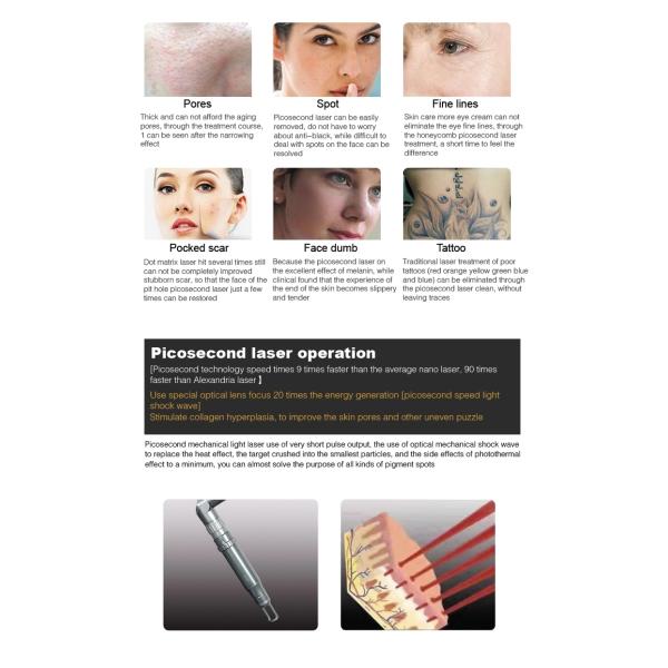 Advanced Fractional Laser Beauty Machine Utilizing Picosecond Laser Q Switching ND YAG Technology for Effective Removal of All Tattoo Colors and Skin Rejuvenation