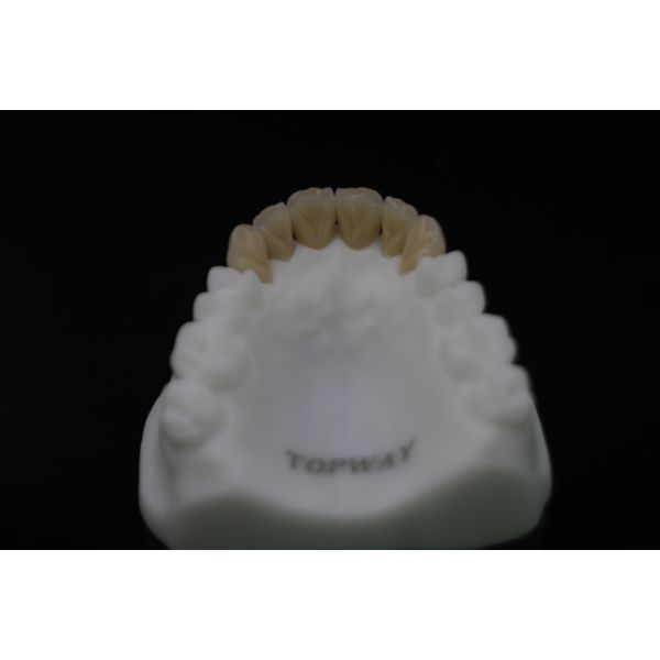 Co-Cr Crown Cobalt-Chromium Dental Crown with High Durability Biocompatible and Corrosion Resistant for Molars and Premolars