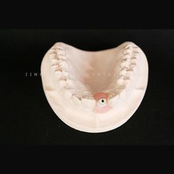 Dental Zirconia Custom Abutment Lab Precise Esthetical As Strong As Titanium