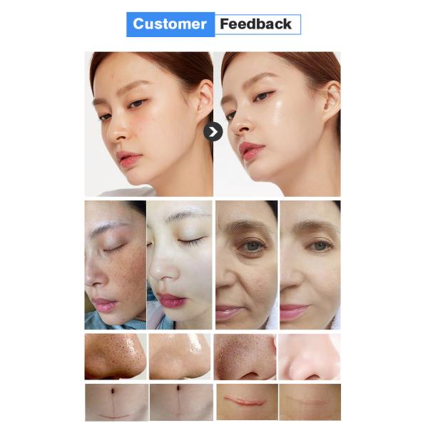 2024 High Quality Korea H2o2 Hydro Beauty Facial Diamond Hydra Dermabrasion Facial Skin Multifunctional Machine