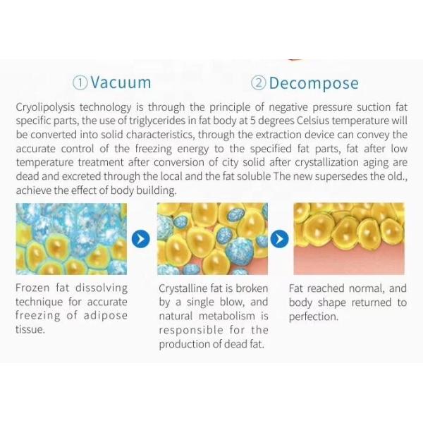 Effective Cryolipolysis Slimming Machine , 4 - Handle Body Fat Freezing Machine