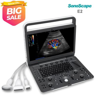 Sonoscape E2V E2 Veterinary Scanner Portable Color Doppler Ultrasound Machine
