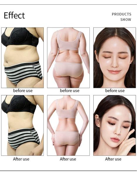 EMS Vacuum RF Slimming Machine , Lipo Laser Beauty 10 In 1 Cavitation Machine