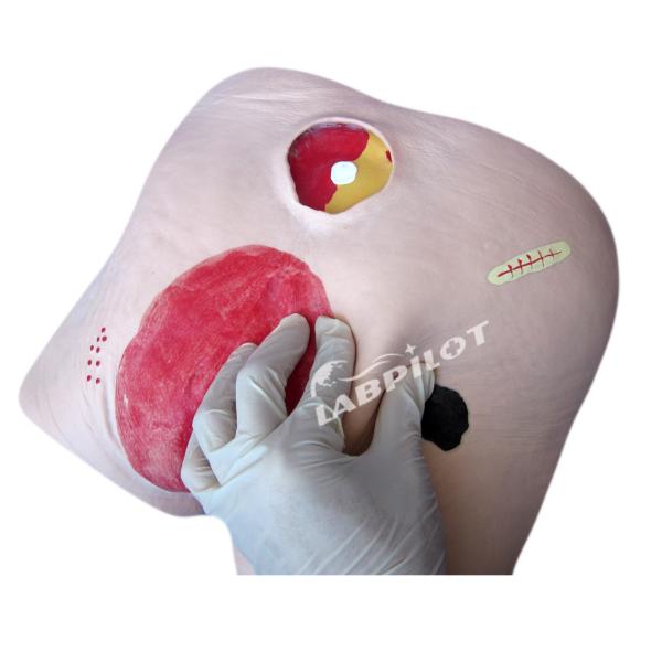 Human Model Decubitus Ulcer Care Training Simulator for Categories in Medical Science
