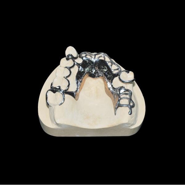 High Accuracy Vitallium Framework Removable Tooth Denture Class 2