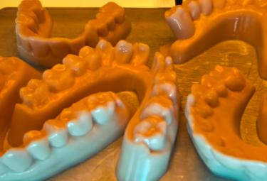 Modelo Resina Dental Contención de forma sólida Tras el enfriamiento Mejor durabilidad