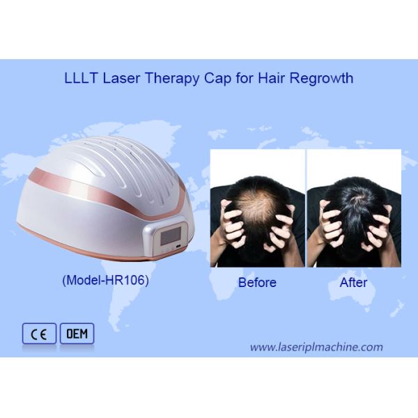 93 LED Beads 650nm LLLT Hair Regrowth Helmet with 20 Minutes Operation for Hair Growth