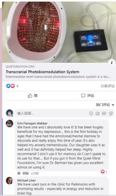 Transcranial Magnetic Stimulation Equipment Treatment Depression RTMS
