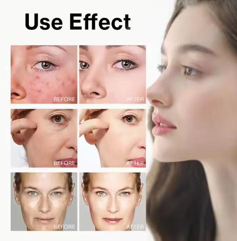 Hot Selling 7% Glycolic Acid Exfoliating Toner Acne Removal Face Skin Care Toner Private Label Glycolic Exfoliating Toner