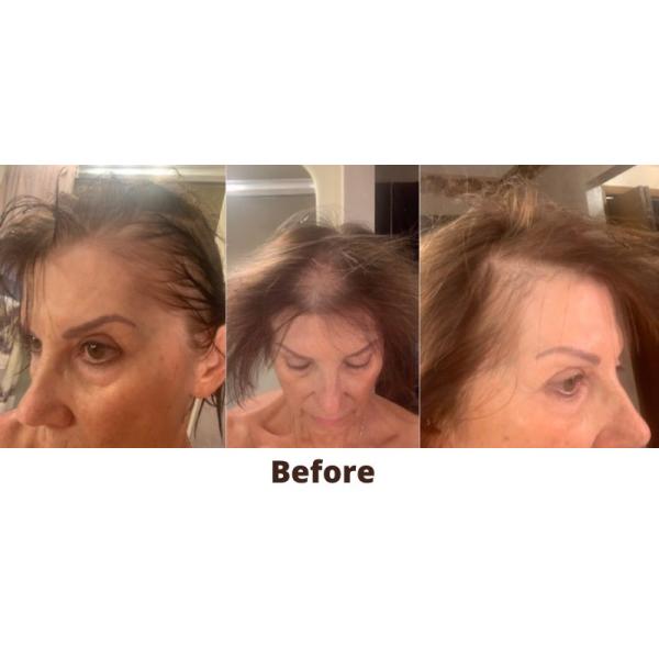 650nm Anti Hair Fall Helmet