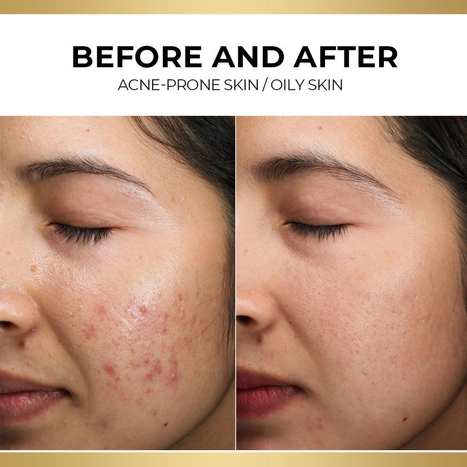 OEM ODM brand organic natural anti-aging and wrinkle resistant facial skincare serum Exosome collagen hyaluronic acid moisturizing and smoothing serum
